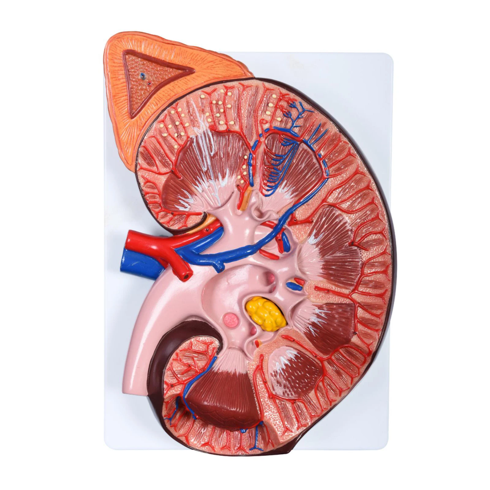 

Anatomical Model of Kidney, Cortex Renal Medical Teaching Nephrology Urology