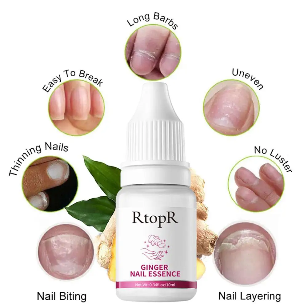 10ML Ginger Fungal Nail Treatment Foot Care Essence Foot Whitening Toe Nail Fungus Removal Gel Anti Repair Fluid Nail Care