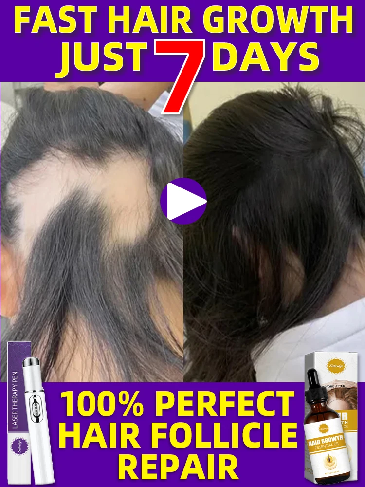 

Laser hair follicle repair for fast hair growth