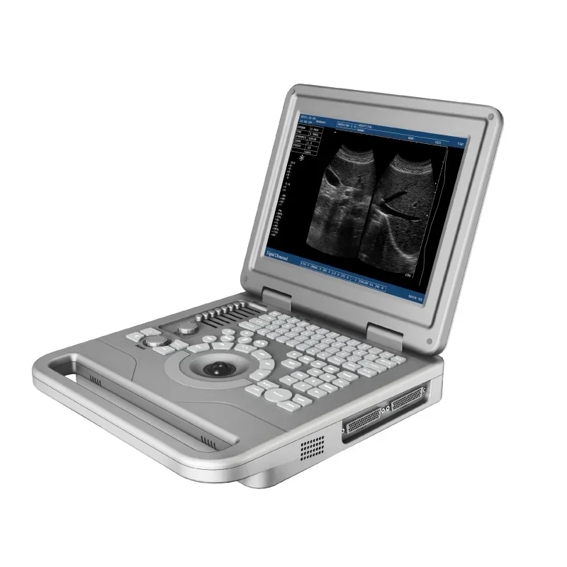 

Hot Favorite Mindray Ultrasound Machine for Human - Uncompromising Quality for Professional Medical Diagnosis