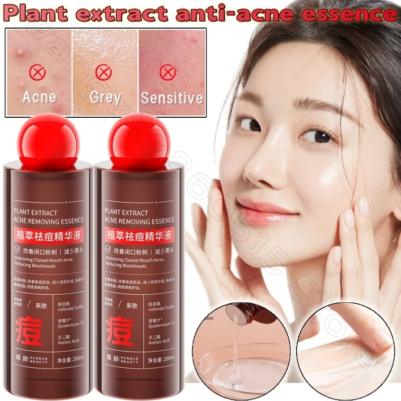 

Plant Extract Repair Essence 200ml Gentle Moisturizing and Brightening Skin Repair Facial Essence for Redness and Sensitive Skin