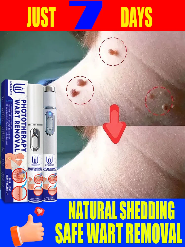 

Varicose vein killer | Eliminate spider web lines | Soothe leg discomfort | Varicose vein treatment