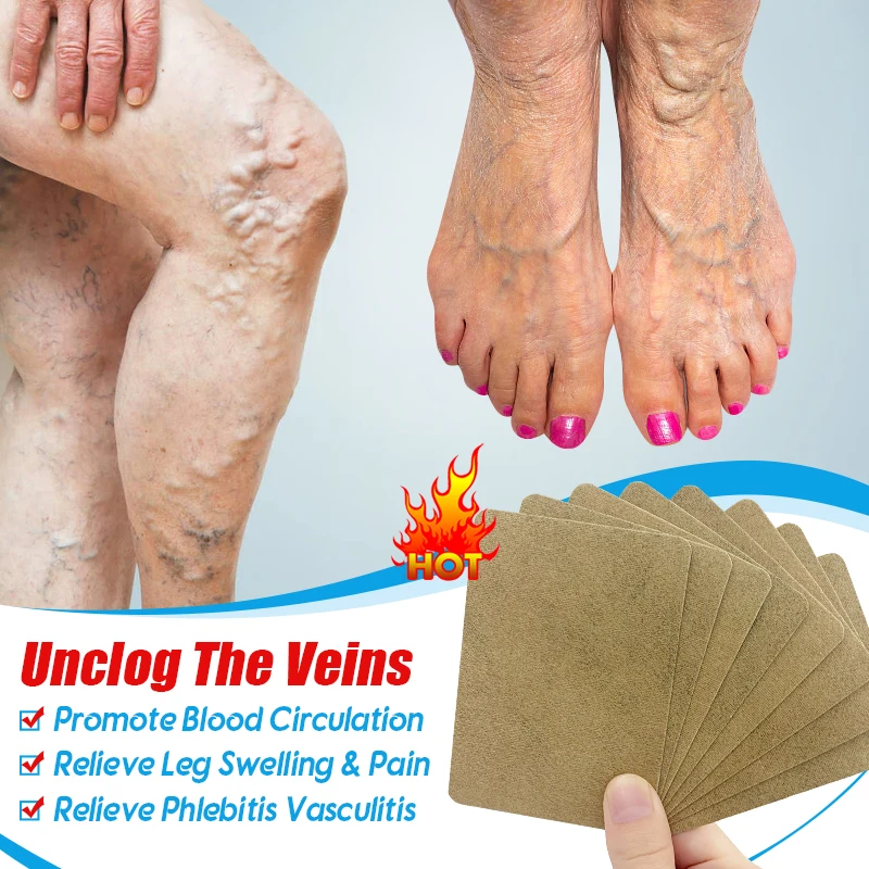 8Pcs=1Bag Varicose Vein Repair Plaster Relieve Leg Vein Bulge Pain Treatment Patch Vasculitis Phlebitis Remove Vein Sticker W019