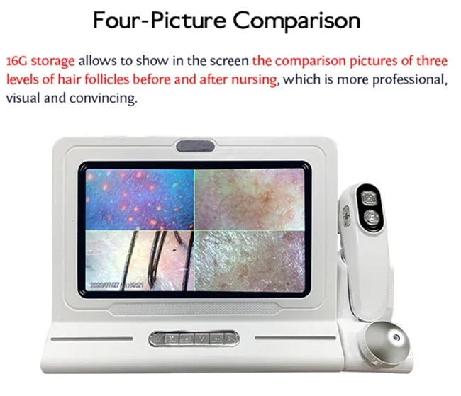 고품질 HD 3D 휴대용 두피 스캐너 감지기 3D 헤어 분석기 기계 IT 얼굴 두피 분석 바디 눈 코 EU ZA