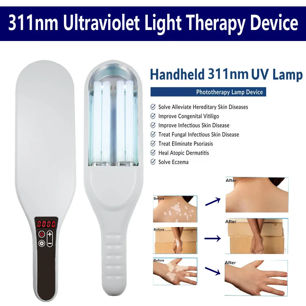 

311nm UVB Treatment Instrument Vitiligo Psoriasis Skin Treatment Device Narrow Band Ultraviolet Phototherapy Lamp
