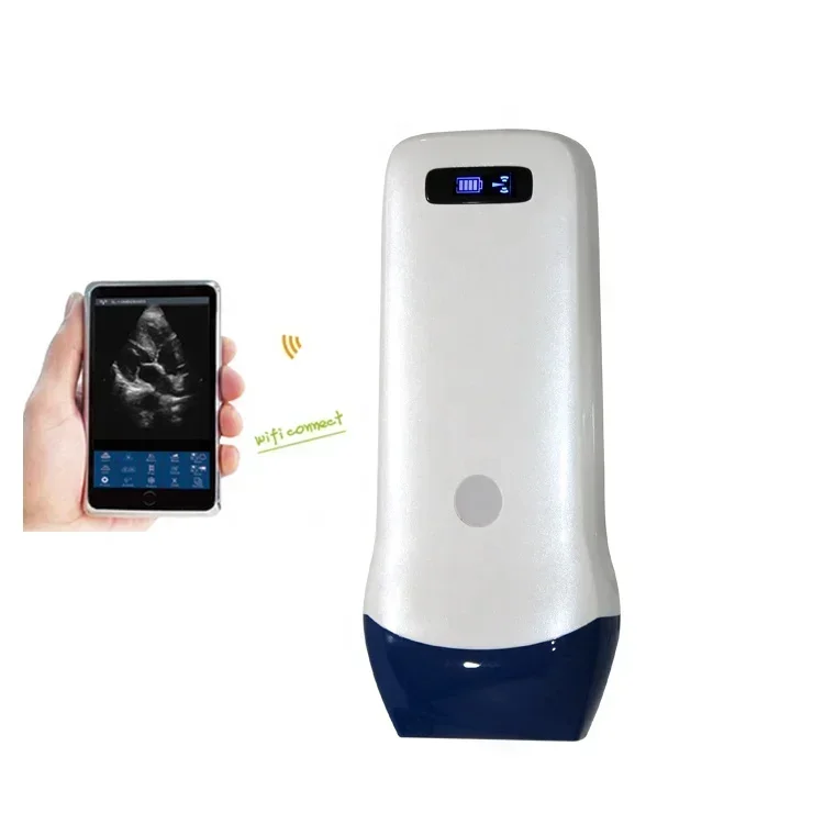 

Linear Probe 3D 4D Color Doppler Ultrasonido Machine Wireless Wifi Portable Ultrasound Scanner