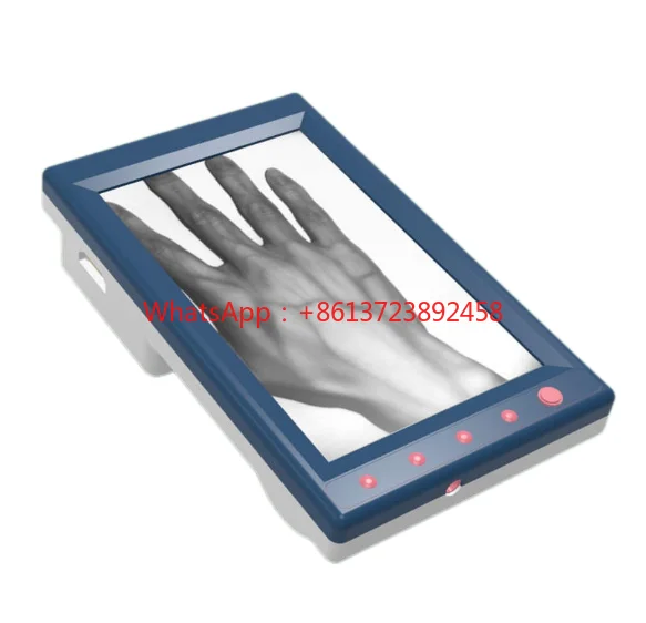 

MC401 Exquisite design economic LCD display portable vein finder good price for hands,legs and face