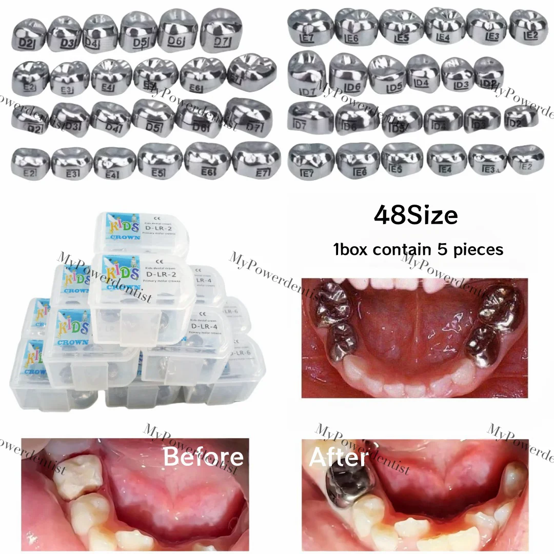 5Pcs Dental Kids Primary Molar Crown Lower Teeth Protect Crowns Stainless Steel Lower Left/Right D2-E7