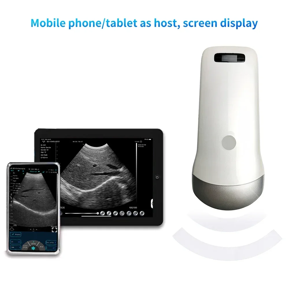 Portable 3.5Mhz Wireless Ultrasound Scanner Convex Probe Support IOS Android Windows Use for Emergency Surgery Healthcare