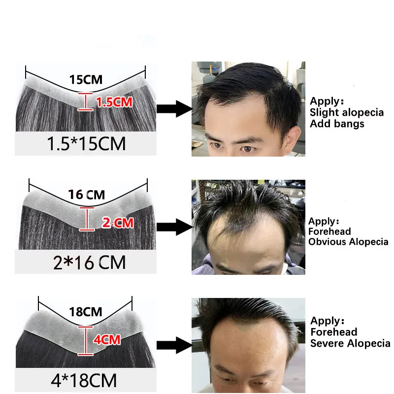 Hotsale 100% Echthaar Stück Männer Topper V Schleife Super Dünne Haut PU Front Linie Stirn System Toupet Patch Perücke für Männer – Detail 6
