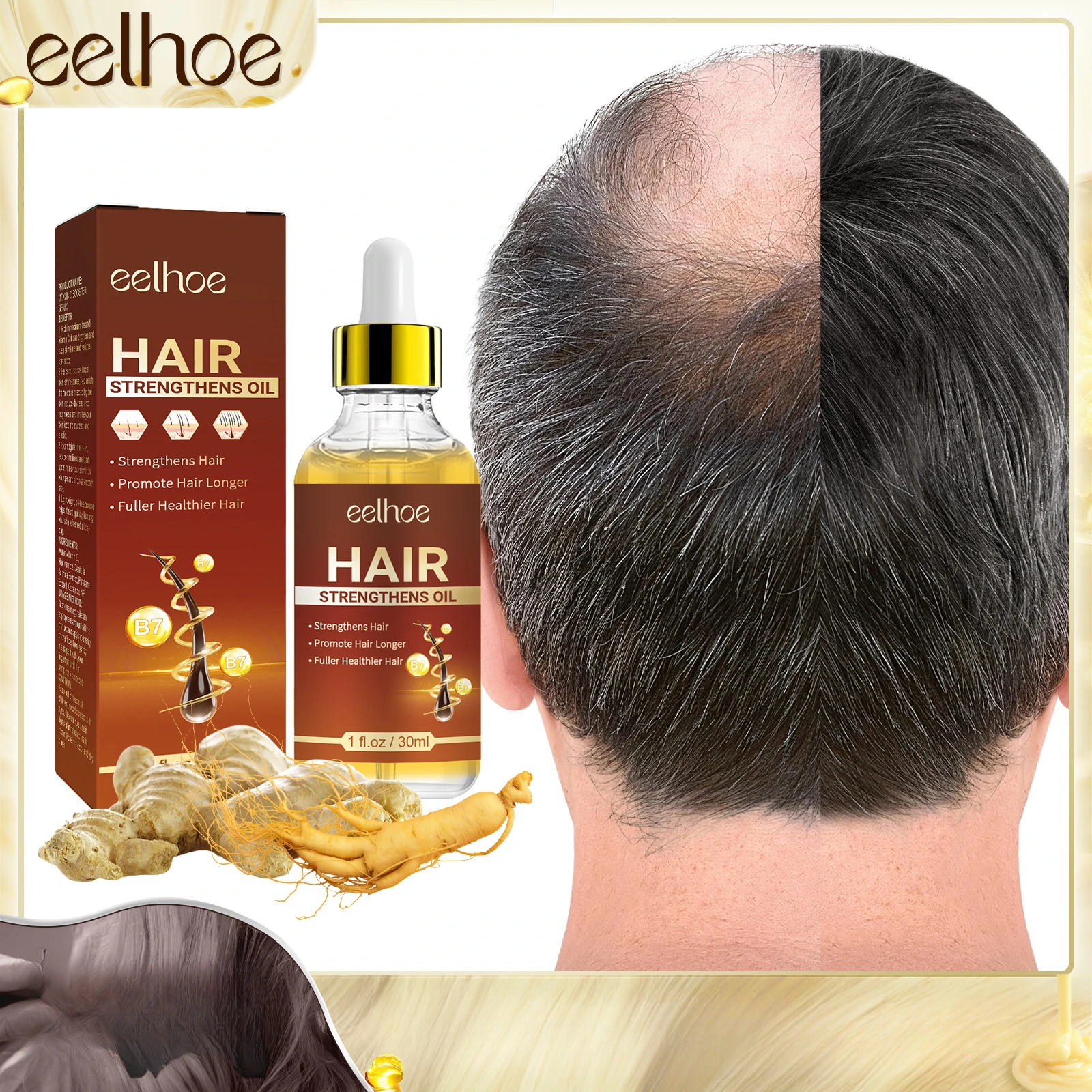 EELHOE-Esencia de aceite de ricino para el cabello, nutre tu cuero cabelludo, espesa y fortalece tu cabello, combate la pérdida de cabello, Ginseng y vitaminas