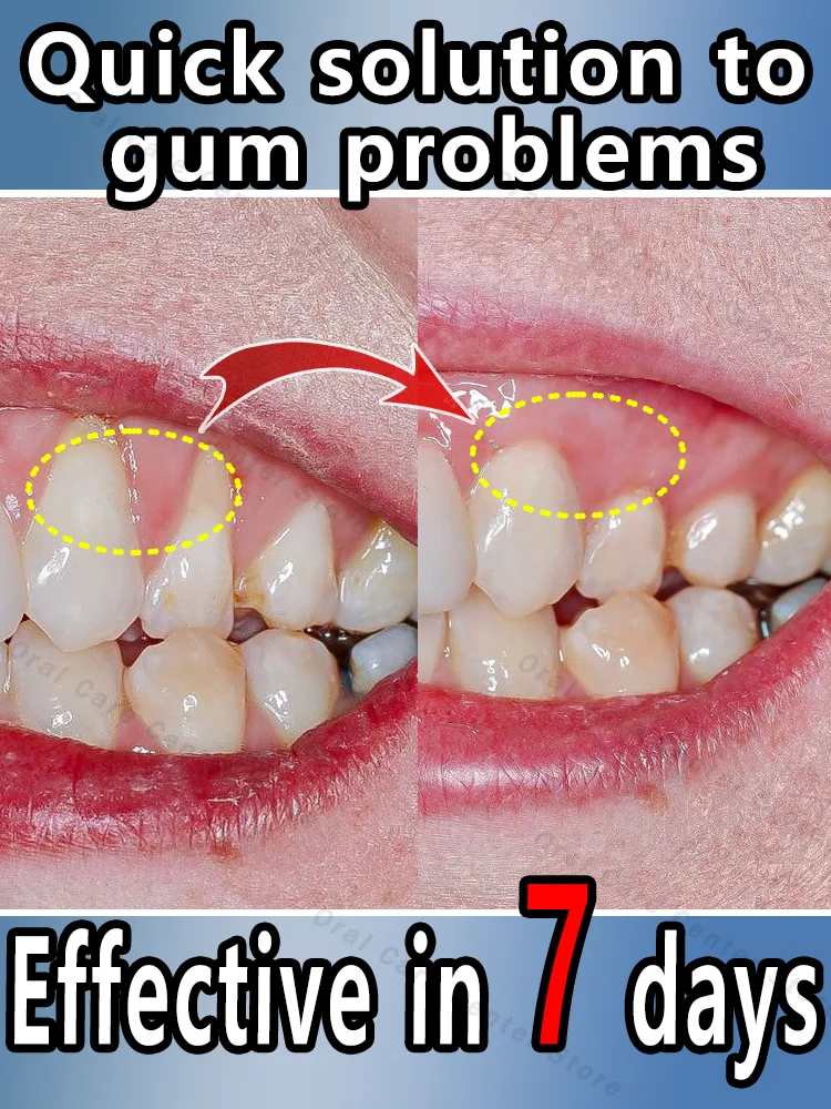 repair damaged gums,Effectively relieve toothache,  and repair bleeding gums