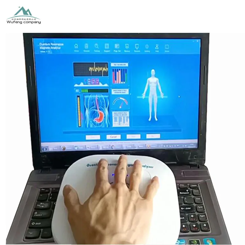 

Best Selling 12th Generation Free Software Download Resonance Magnetic Analyzer For Health Testing