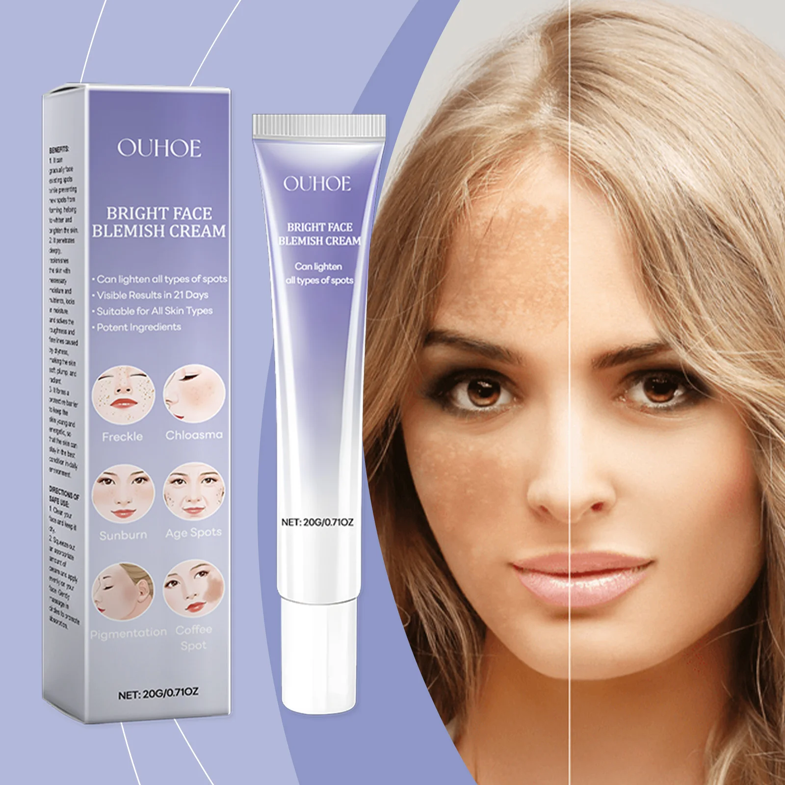 Ouhoe Facial Spot Remover Nourishes, Moisturizes, Lightens, Lightens and Firms Skin face cream Spot lightening face cream