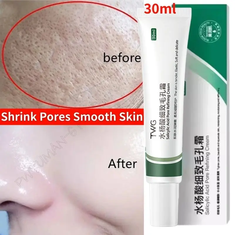 Salicylic Acid Pores Shrink Refining Cream Treatments Large Open Pore Remove Black Dots Blackhead Acne Mark Korean Moisturizing