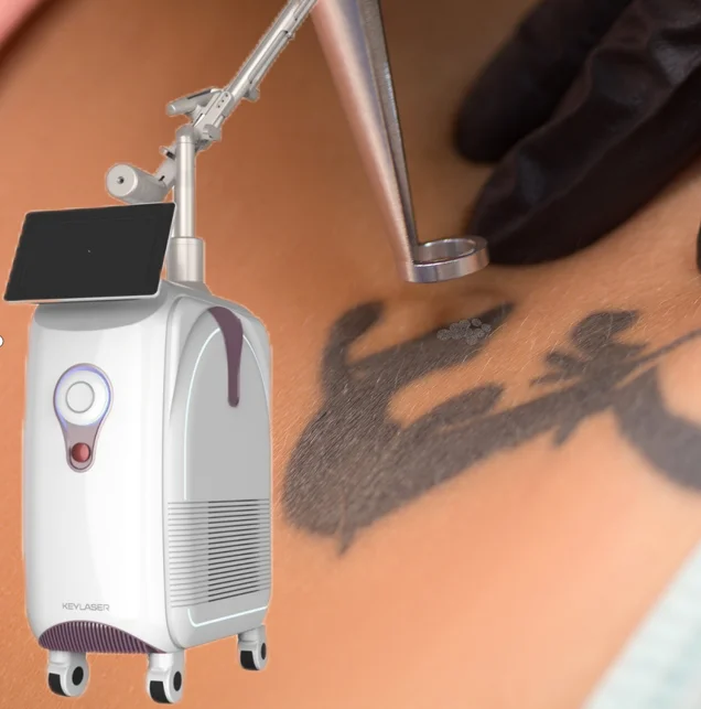 Professional Picolaser Tattoo Removal Laser Q Switched ND YAG Laser Picolaser OEM Picosecond Laser