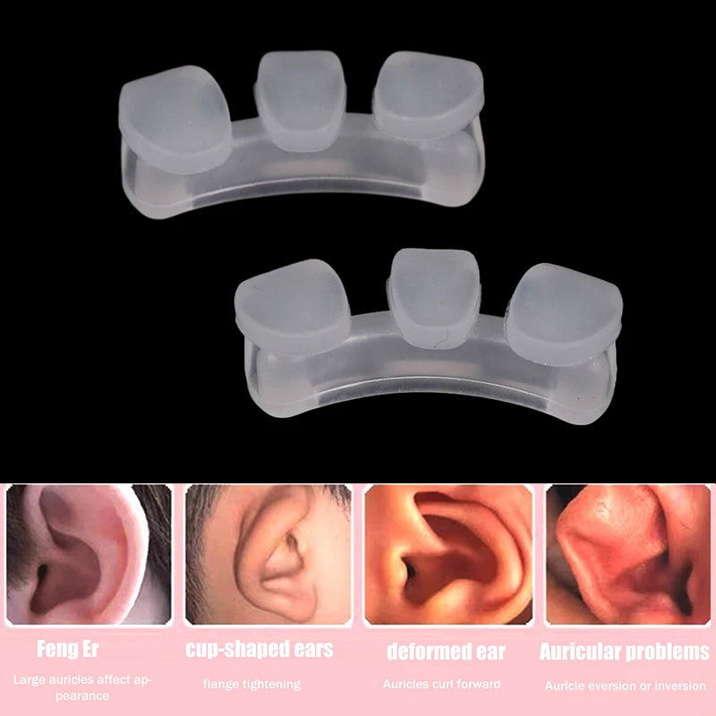 Baby External Auricle Corrector 1/2Pcs Protruding Ear Support Pads Infant Ear Correction Tools