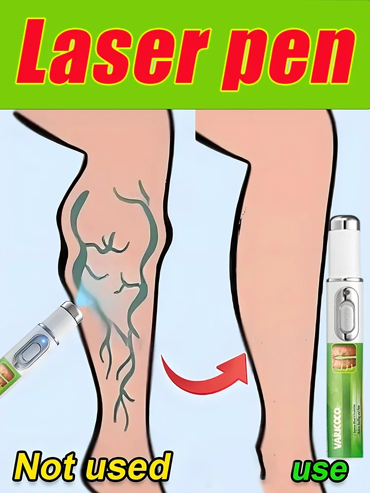 

Laser Therapy Leg Repair Pen