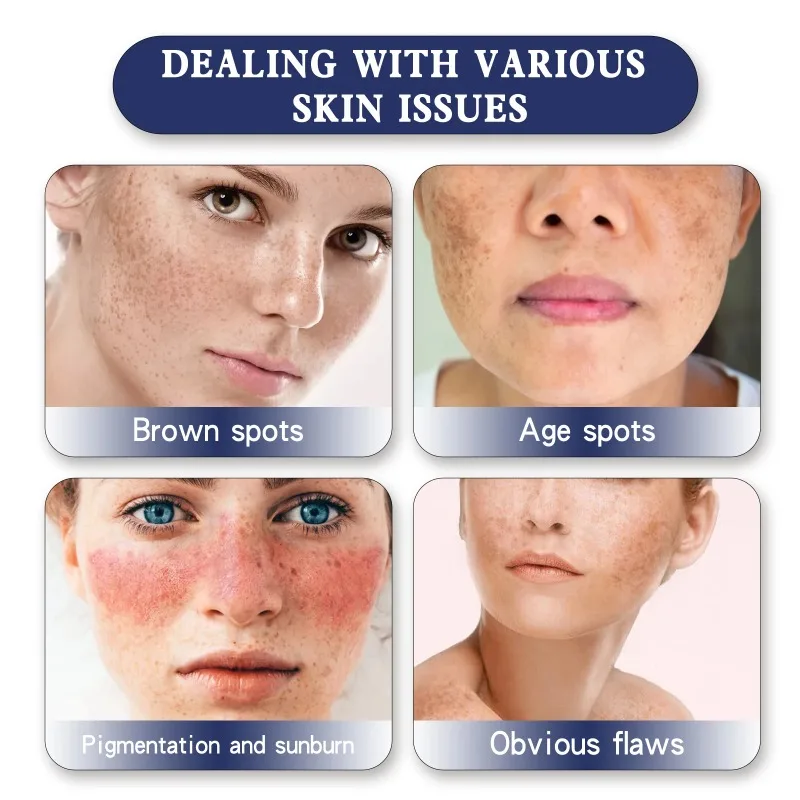 Brightening Moisturizing Face Cream Fade Melanin Pigmentation Reduce Fine Lines Shrink Pores Soft Whitening Facial Beauty Cream
