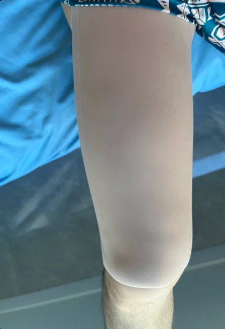 Silicone Leg Beauty Leg Cover, Thigh Modification Elasticity Increases Birthmark Scar Cover