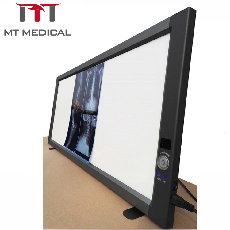 MT Medical Hot Sales Super Thin LED Triple Panel X-RAY Medical Film Viewer Medical Film Viewing Box (LED Light)