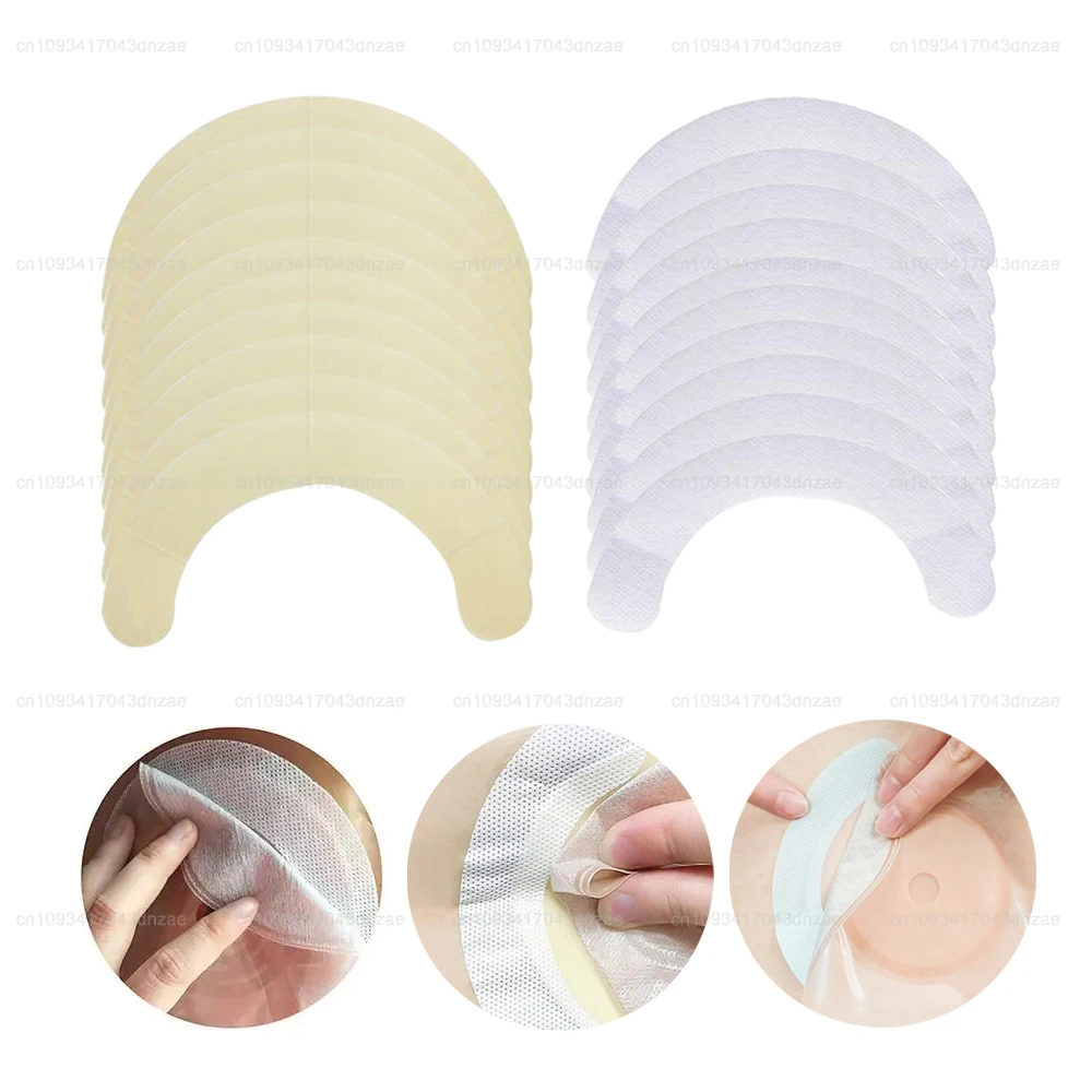 

20/40 шт. портативная лента для ухода за стомой, распущенные ленты для фиксации колостомических мешков, предотвращающие деформацию и сминание, медицинские