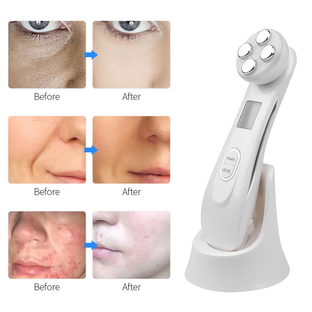 5 In 1 Facial Massage Device Rf Facial Lifting Device Skincare Facial Massage Device Ems Micro Current Tightening Facial Beauty