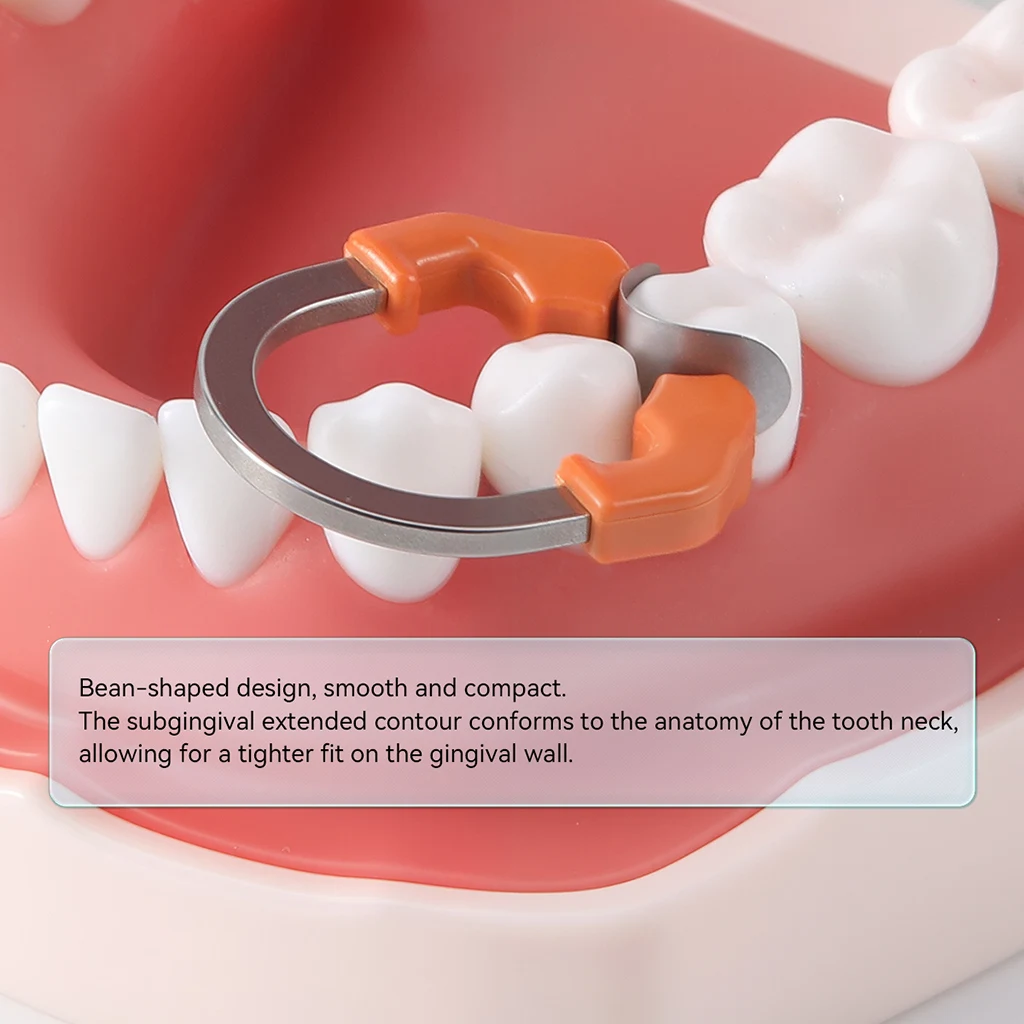 100 Stück/Packung AZDENT Dental Metallmatrizen, Sektionale Matrizenbänder, Konturiert M10, Harte Nachfüllformblätter, Sterilisierbar, für Zahnmedizin – Detail 6