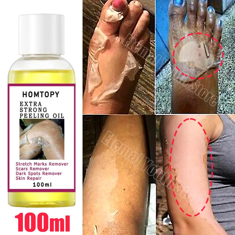 Body Care Exfoliating Yellow Peeling Oil 100% Organic Bleaching Dark Skin Serum Dark Knuckles Fast Whitening Product Cosmetics