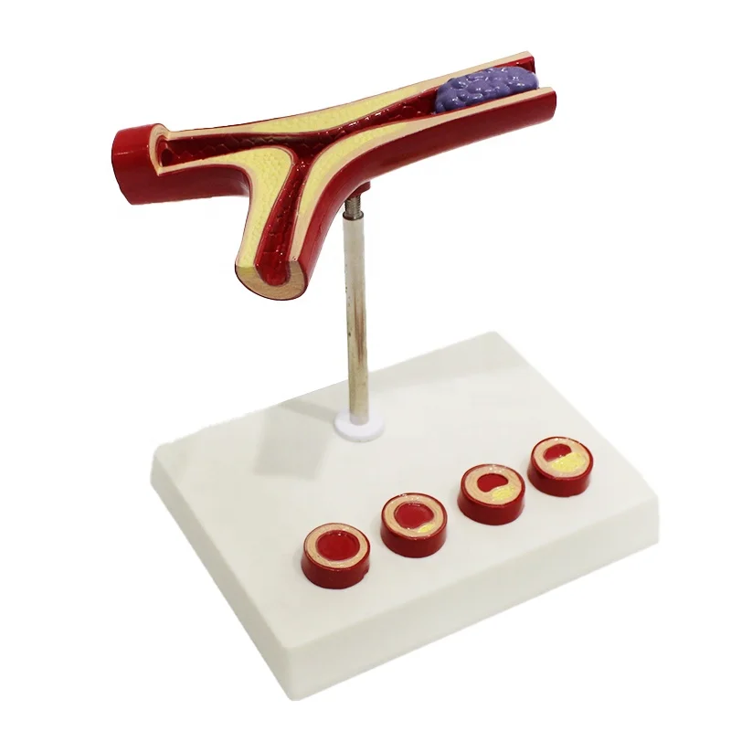 Cardiovascular model simulation teaching model, medical education