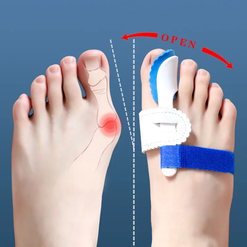 Korektor palucha koślawego Stopa do separatora palców Haluksy Bunions Paluch koślawy Rozrzutnik palców Separator palców Korektor palców Bunion