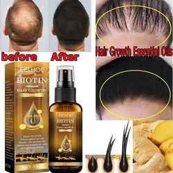 Biotin Fast Hair Growth Products Anti Hair Loss Serum Spray Prevent Baldness Treatment Scalp Beard Beauty Hair Care Men Women