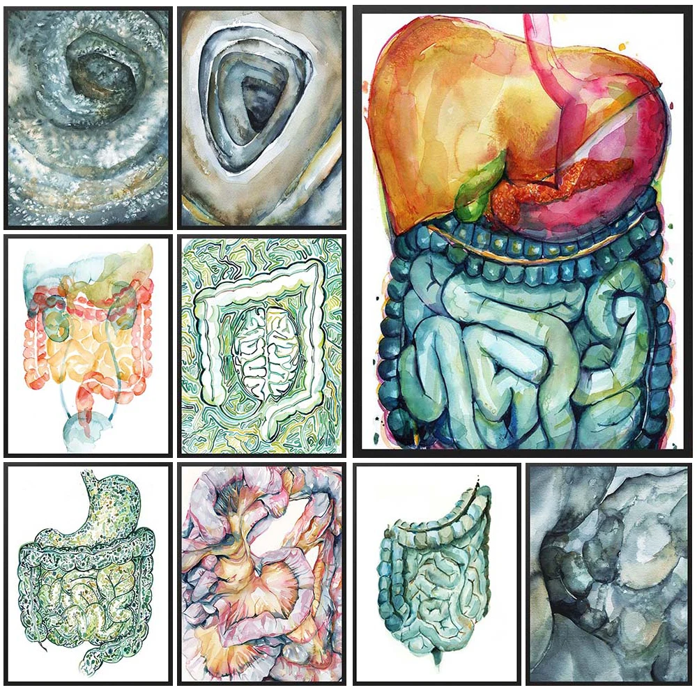 

Intestines Large Intestine Organ Colonoscopy Poster Wall Art Canvas Painting Home Decor Wall Pictures For Living Room Unframed