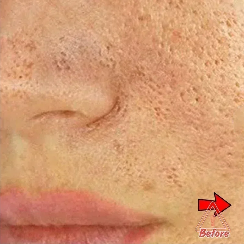 Poro Facial Soro Encolhendo, Poros Finos, Refirmante, Aumentando Elasticidade Da Pele, Hidratante, Essência Iluminante, Cuidados Com A Pele, 01