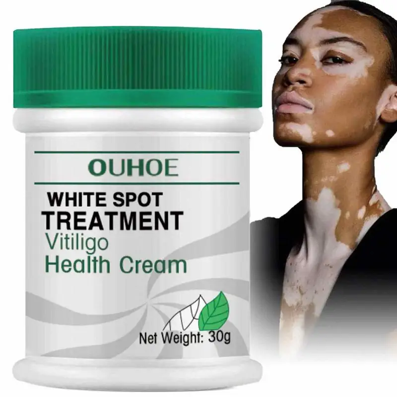 White Spot Cream Vitiligo Repigmentation Cream For White Spots On Skin 30g Effective Vitiligo Relief Cream Reduce White Spots