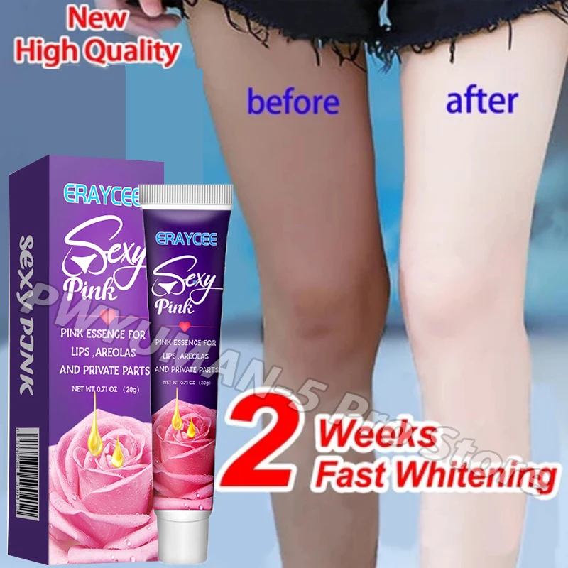 Brightening Cream For Intimate Parts Body Knees Remove Dull Pigments Brighten Serum Elbows Knuckles Lightening Skin Care Product