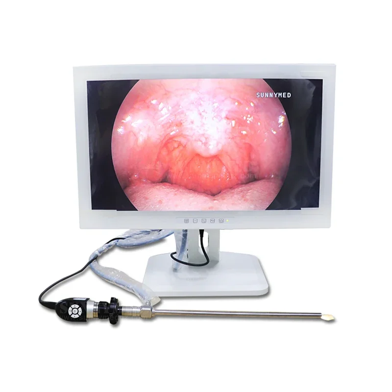 SY-PS047 All-in-one Integrated Endoscopic cmara endoscopica porttil HD endoscopy system