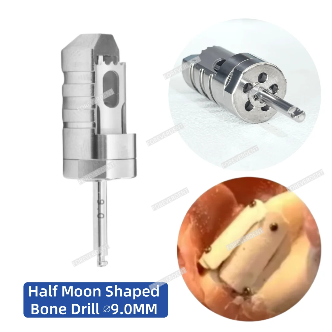 

9,0 мм стоматологическая полумесяцная кость, сверло для отбора проб, трепан, инкрементальные сверла для ломтиков костей, 1 шт.