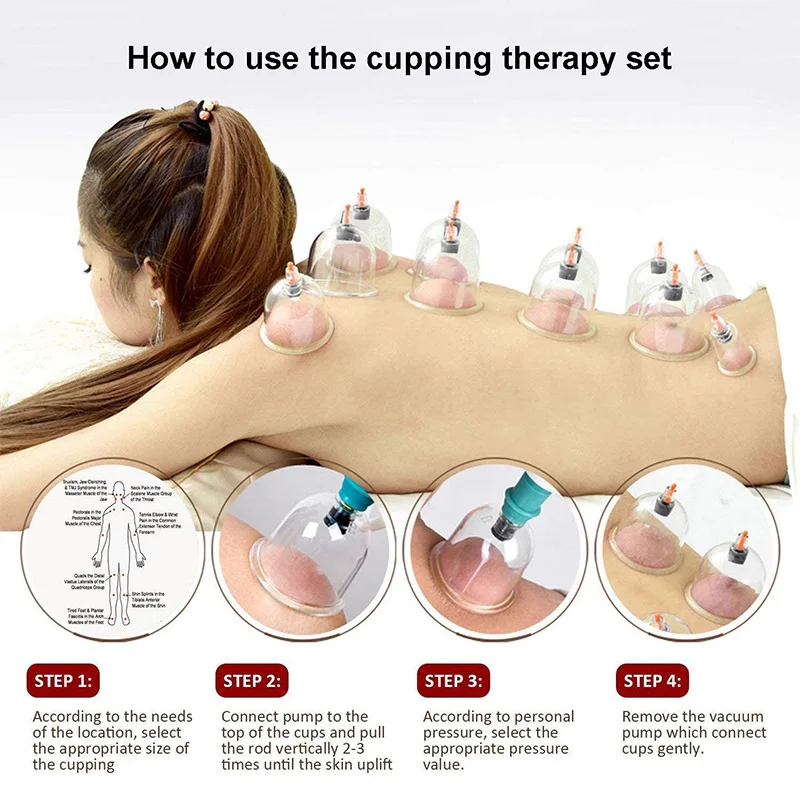 6or24 Stuks Zuignappen Massage Vacuüm Cupping Body Massager Plastic Vacuüm Zuigtherapie Cupping Set Blikjes Voor Massage