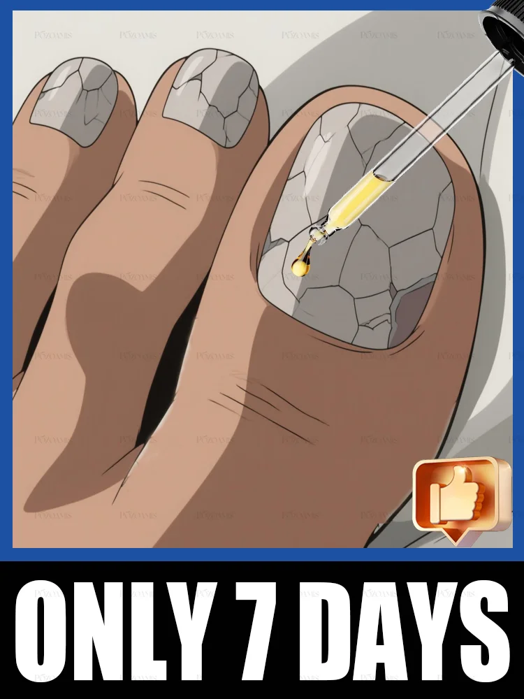 Bᴏᴛᴀɴɪᴄᴀʟ-Bᴏᴏsᴛᴇᴅ Fᴏʀᴍᴜʟᴀ ᴛᴏ Wɪᴘᴇ Oᴜᴛ Fᴜɴɢɪ & Rᴇɪɴᴠɪɢᴏʀᴀᴛᴇ Hᴇᴀʟᴛʜʏ Nᴀɪʟ Gʀᴏᴡᴛʜ, Fɪᴛs ғᴏʀ Hᴀɴᴅs ᴀɴᴅ Fᴇᴇᴛ, Tʀᴇɴᴅɪɴɢ ɪɴ 2025 #1