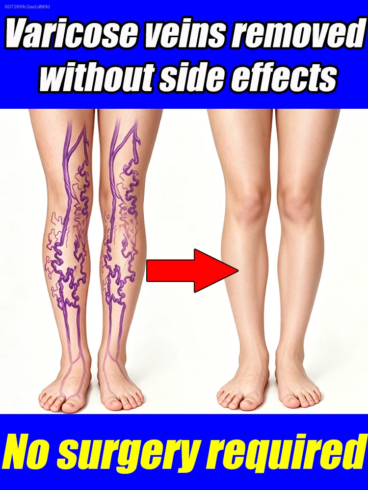 

Suitable for people who stand for long periods of time, new product launch, leg care.