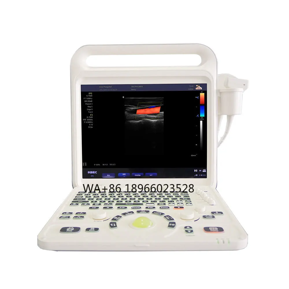 LTUB63 Medical Ultrasound Instrument Portable Clinical Medical Notebook Computer 4D 3D Color Ultrasound Machine