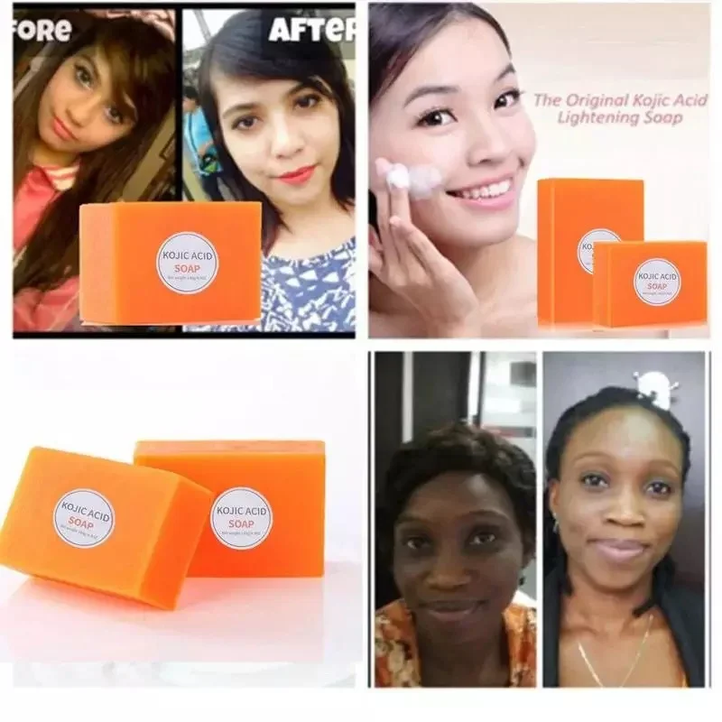 Remove Melanin Kojic Acid Soap Exfoliating Moisturizing Brightening Skin Tone Lifting Skin Firming Handmade Kojic Acid Soap