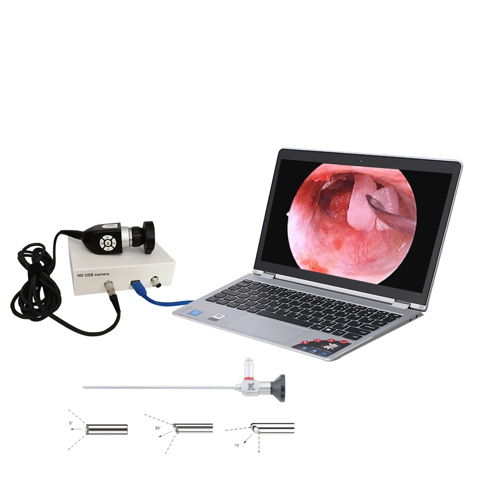 Shrek Mini Endoscope System hd Medical Usb Ear Scope Camera for Hospital