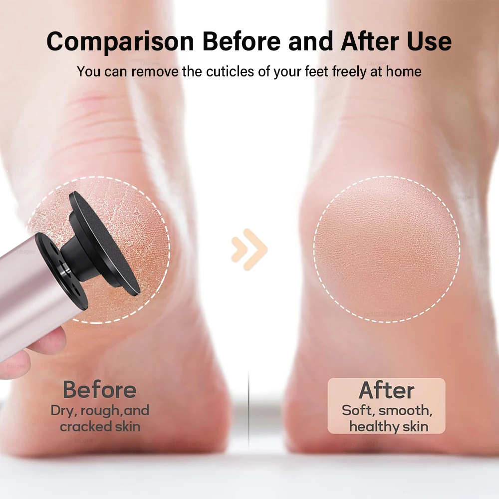 مزيل مسامير القدم الكهربائية المحمولة ملف القدم كعب مزيل الكالو الميت التلقائي طاحونة القدم قابلة للشحن قدم باديكير أداة