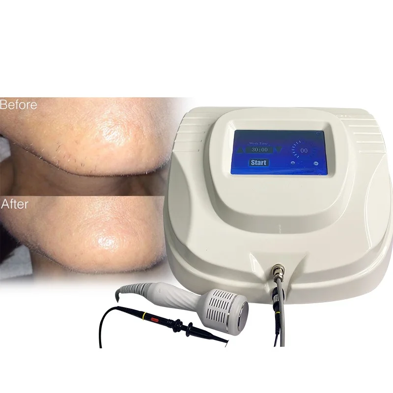 Portable Electrolysis White Hair Removal Machine Professional Needle Electrolysis Hair Removal Non Invasive Hair Removal Machine