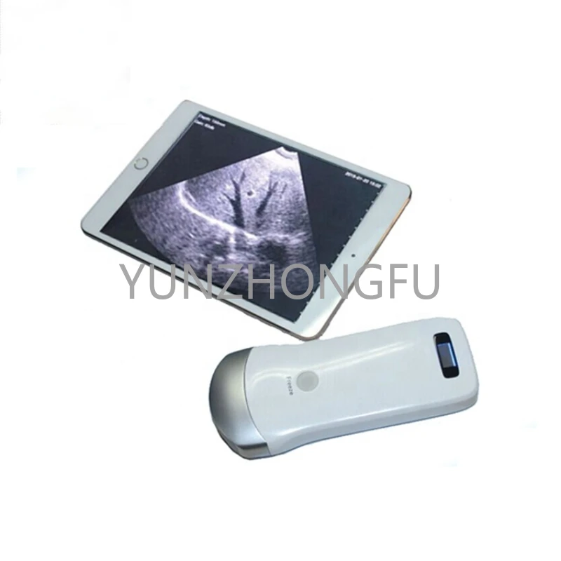 

Mini wireless wifi ultrasound / convex echo usg MSLPU31