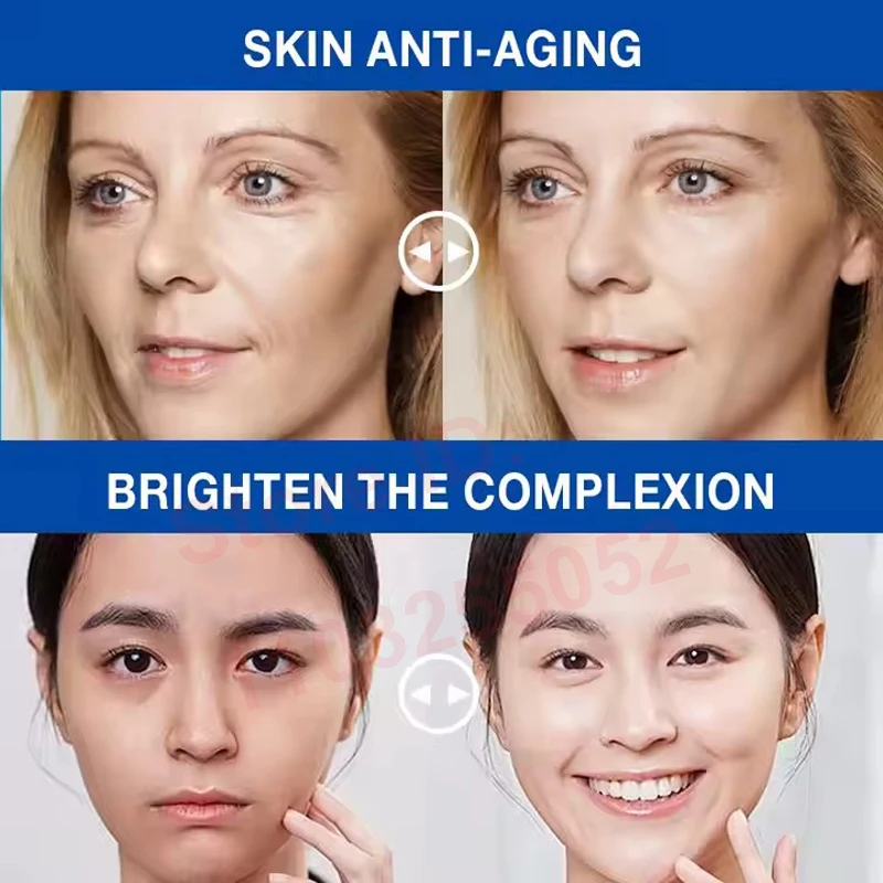 Thumbnail 4 - #64 Best Acne Treatments & Kits to Buy In 2026