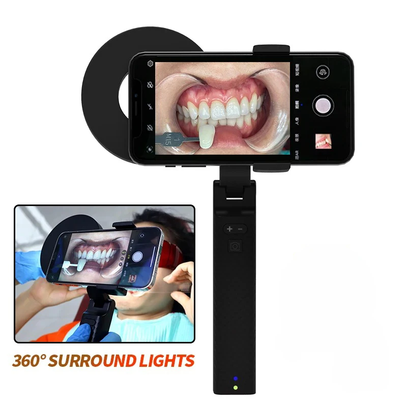 VVDental Dental Photography Flash Light Dentistry Photo Fill Light 18 LED Dentist Lighting for Surgical Treatment Brightness Twi