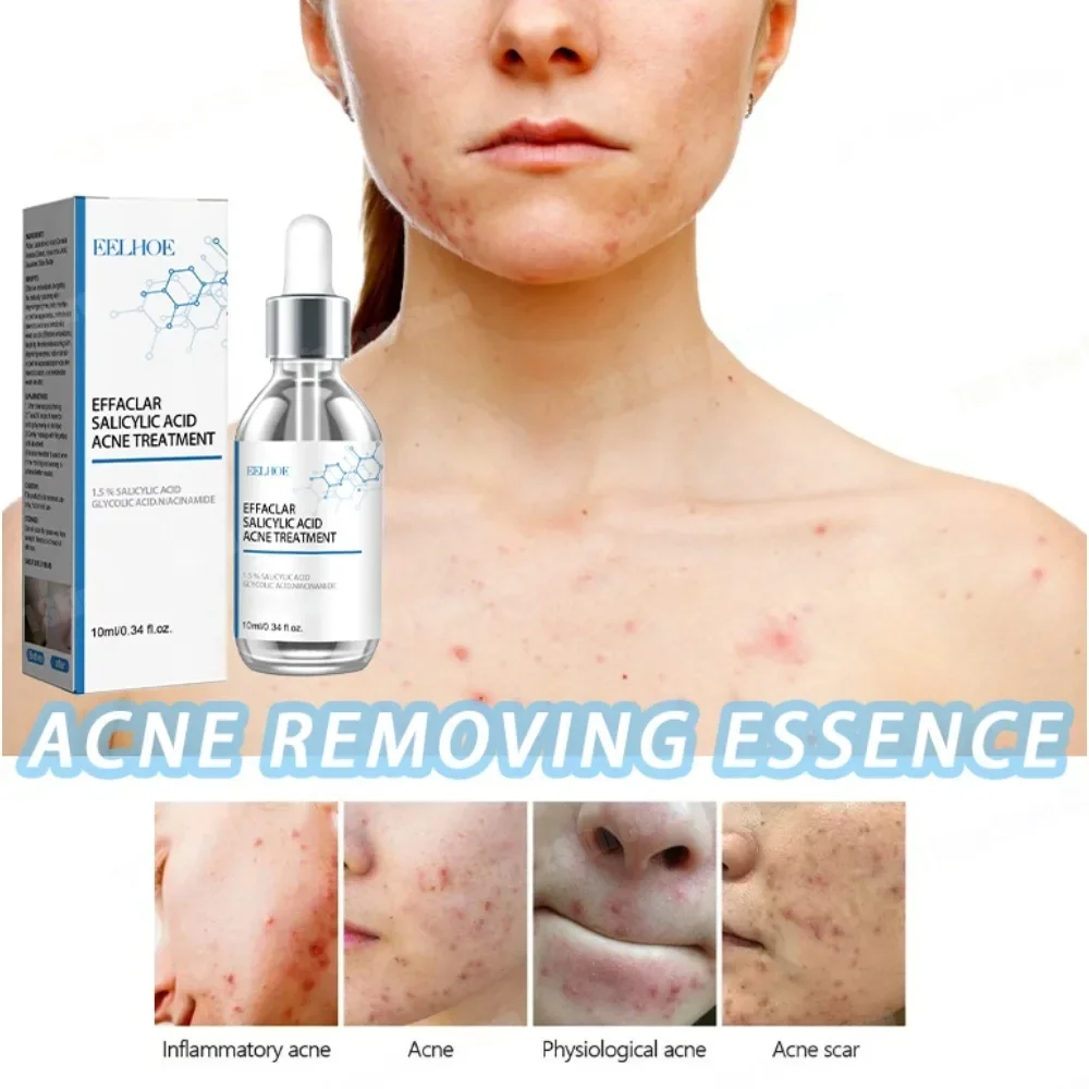 

Repairing Acne Serum for Face, Pimple Remover, Minimize Pores, Control Oil Skin Care